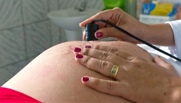 © Arquivo/MDS Exame pré-natal reduz chance de bebê nascer com anomalia